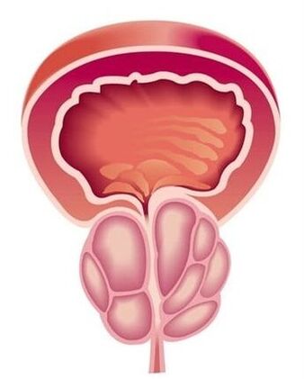 Prostatīta simptomi vīriešiem