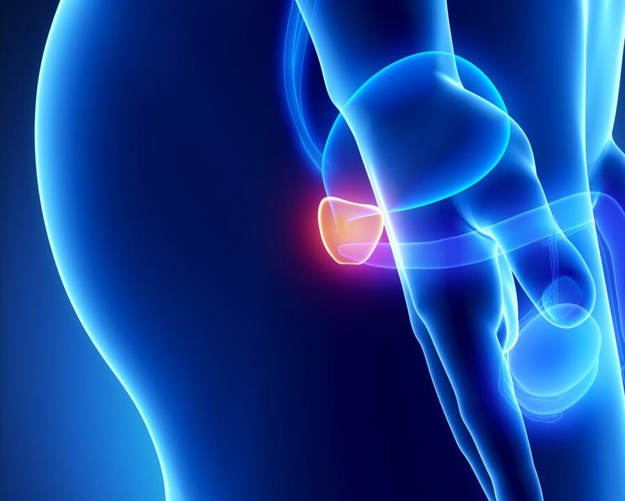 Prostatas dziedzera iekaisums